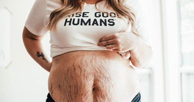 10 women reveal what postpartum bodies really look like