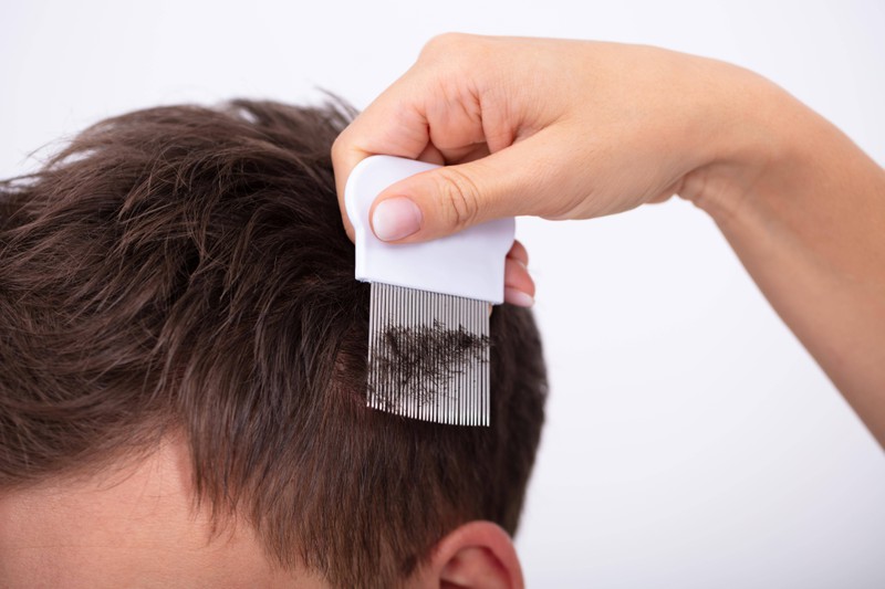 A doctor examines the scalp of a patient.