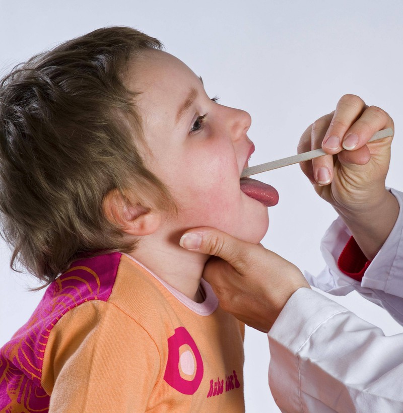 Tonsils are often removed, especially in children.