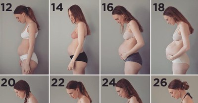 Pregnant With Triplets: Woman Shows What Her Baby Bump Looks Like!