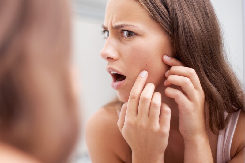 Blind pimples are annoying, but they can be easily removed.