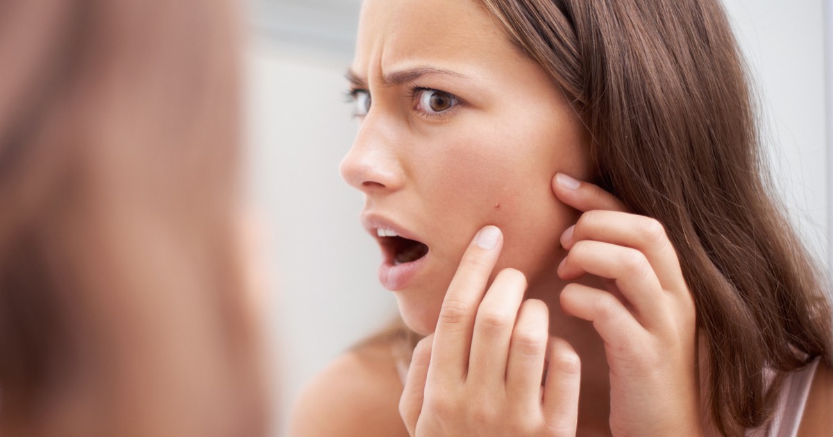 Blind Pimples: Here's How To Get Rid Of Them Fast - It Helps!